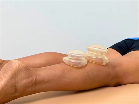 Cadence Physio & Rehab - Physiotherapist In Cambie, Vancouver