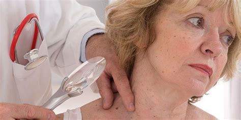 Skin Cancer Symptoms | Prevention