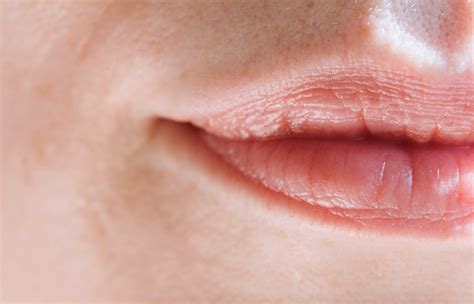 Understanding the Causes and Solutions for a Right-Side Lip Twitch 8