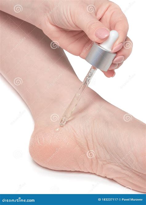 Woman Cares for Dry Skin of Heels, Dry Foot Skin Treatment, White