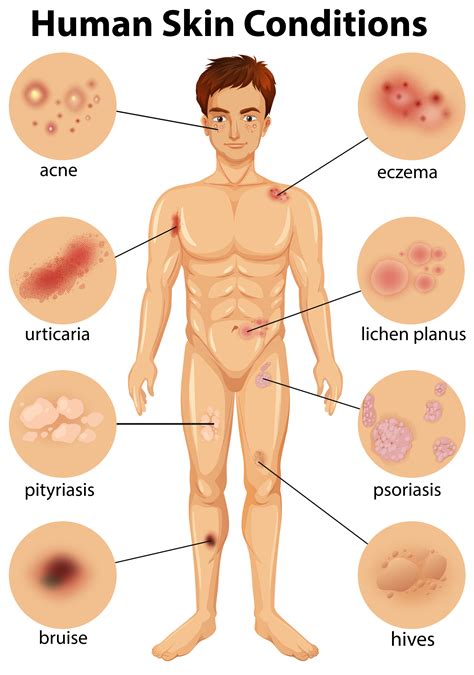 Various human skin conditions 300491 Vector Art at Vecteezy