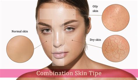 products  dry skin  oily skin