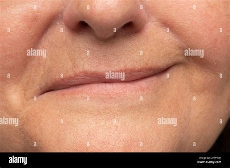 Bell's palsy hi-res stock photography and images - Alamy