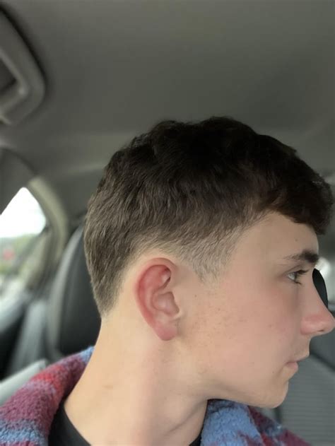 candidate  jaw surgery   side   jaw  slanted