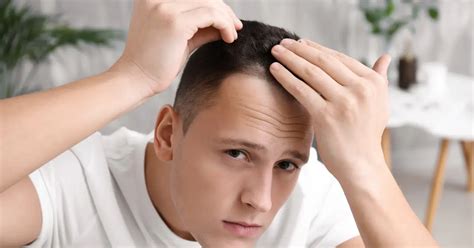 Hormonal Hair Loss: Take a Closer Look