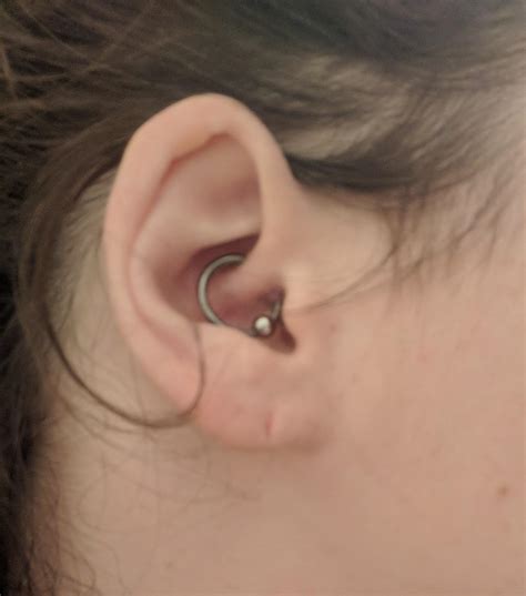 Ripped Earlobe - what can i do? : piercing