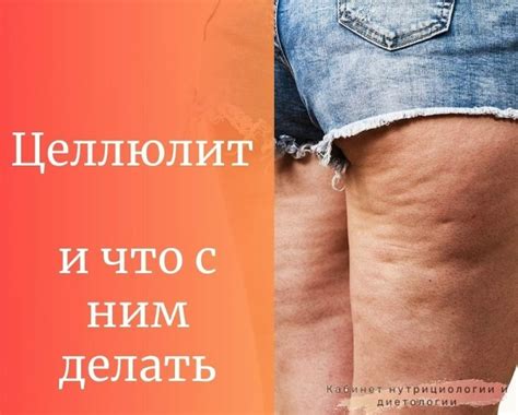 tsellyulit moya istoriya kak spravitsya pochti vse chto proiskhodit