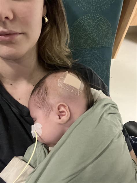 Baby has severe bilateral grade 4 and grade 3 IVH and Ventriculomegaly