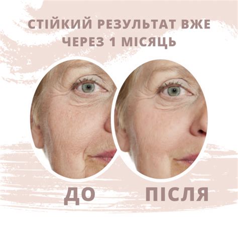 Купить кинезио тейп для лица Kindmax Face Tape в Украине | physiokit.com.ua