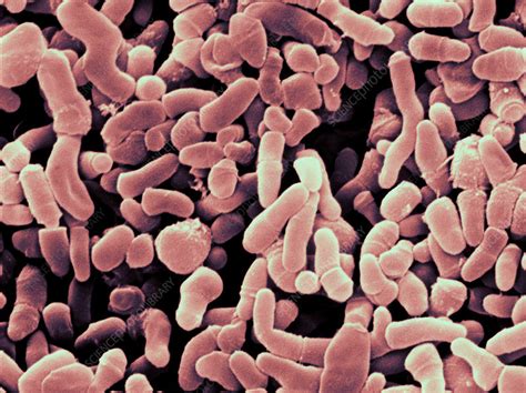 Propionibacterium Acnes Bacteria - Propionibacterium Acnes Bacteria, SEM - Stock Image - C028/2581 ...