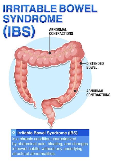 gut diagram vectors illustrations