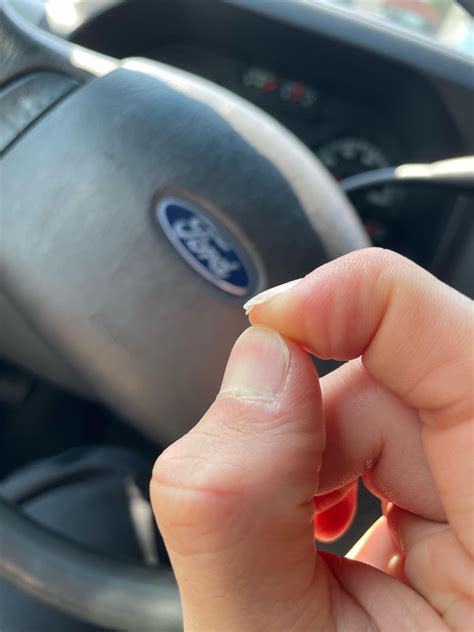 Nail growing under nail : r/nailhealth