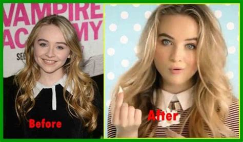Unveiling Sabrina Carpenter A Journey Through Time From Before Plastic Surgery To Her Current Look