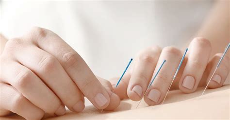 mengenal terapi akupunktur medik  program hamil