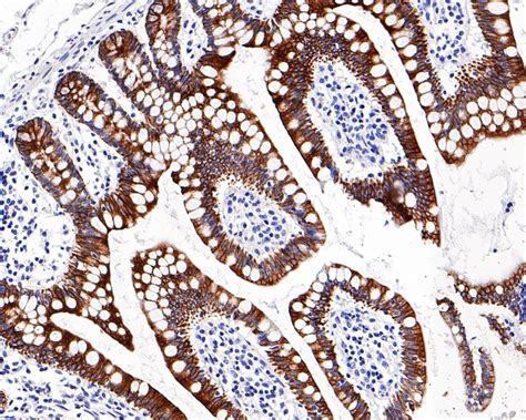 pan Cytokeratin Recombinant Mouse Monoclonal Antibody [PD00-15] (HA601