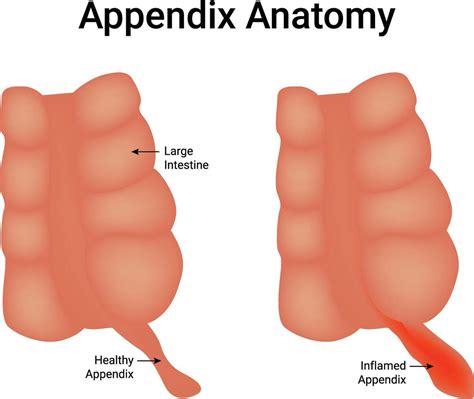 appendix diagram vector art icons  graphics