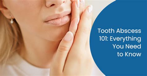 Tooth Abscess 101: Everything You Need to Know | Bristol Dental