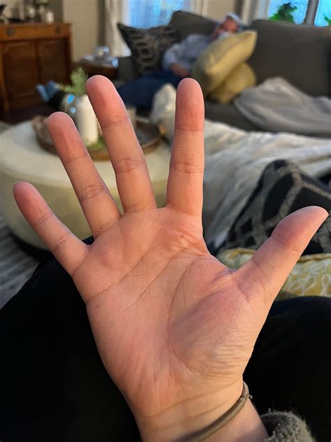 dupixent injection site--least painful? I have done three injections so