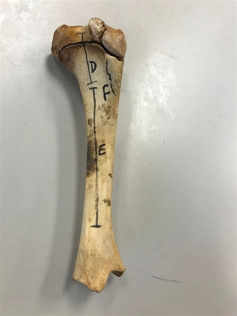 ANFS Practical 1. (Long Bone) Diagram | Quizlet
