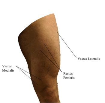 surface anatomy advanced anatomy  ed