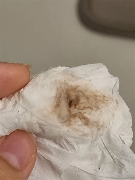 Non cyclical bleeding? What could be causing this? I also had my last