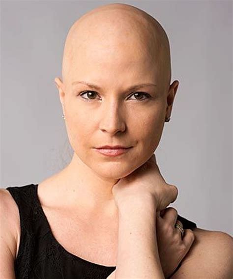 bald women hairstyles
