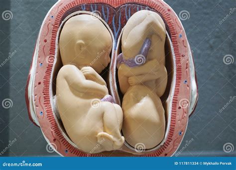 Twins Embryo Model, Fetus For Classroom Education. Stock Photography ...