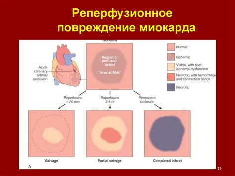Недостаточность кровообращения - online presentation