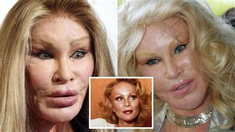 Jocelyn Wildenstein Before Surgery—Catwoman's Photos