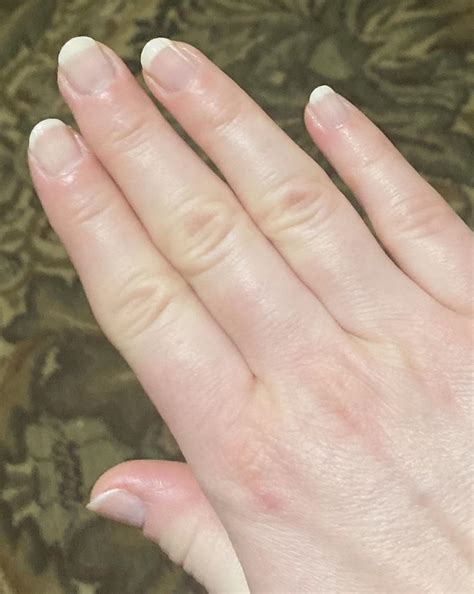 tips for lizard biting naturally 11