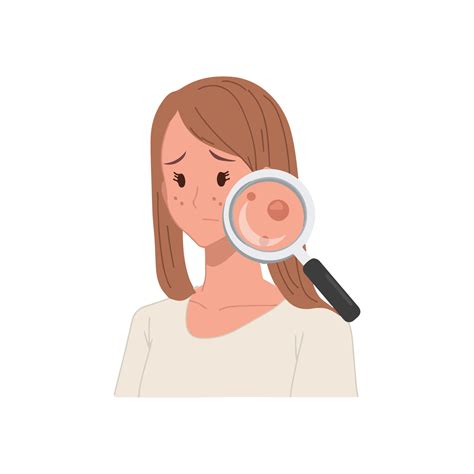 Acne allergies vector inflammation damage scar disease design 16176712