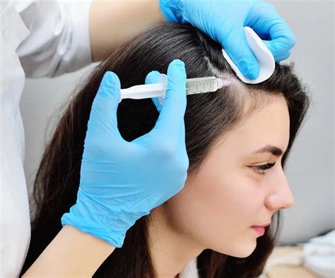 prp hair treatment near me 10