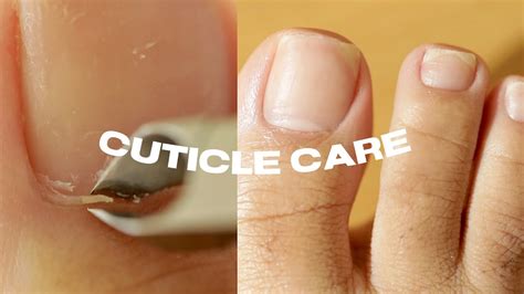 pedicure transformation   cut cuticles  home youtube
