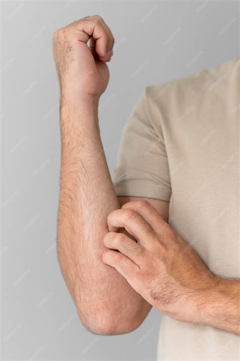 Free Photo | Skin allergy reaction test on arm