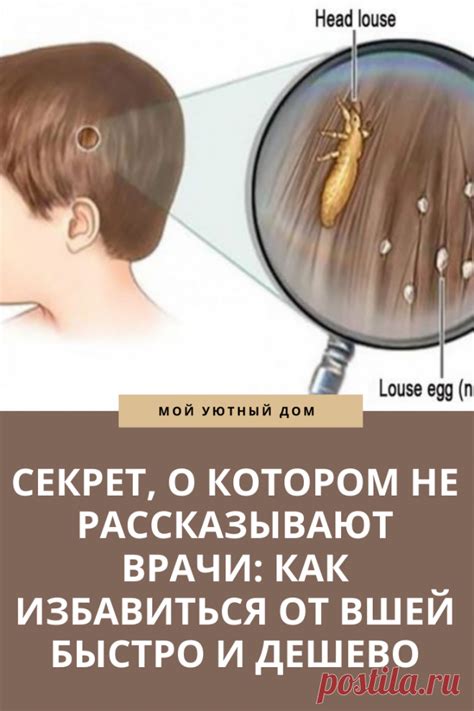 Как быстро и легко избавится от вшей | Полезные Советы | Постила