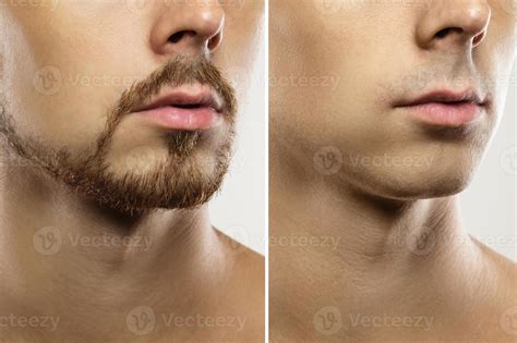 Male face Before and after shaving comparison. 16233976 Stock Photo at ...