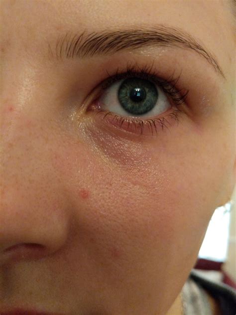 fine line under eye 4