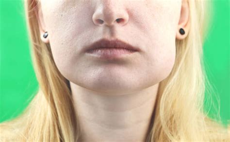 550+ Swollen Cheek Stock Photos, Pictures & Royalty-Free Images - iStock