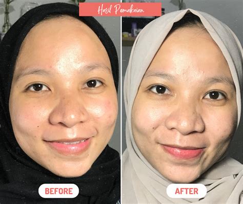 SNP Prep Peptaronic Serum Review, Hydration Serum For Oily Skin