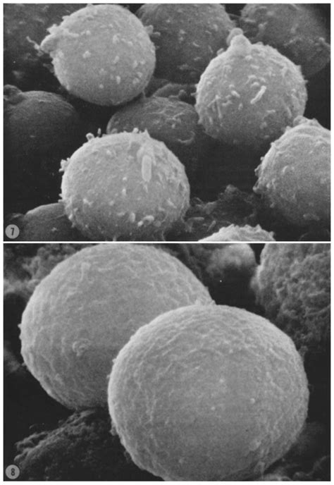 human thymic cells  generally smooth  cell surface morphology