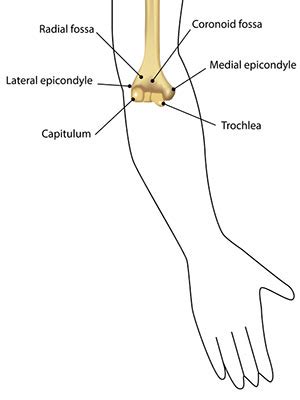 Types of Epicondylitis