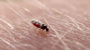 Midge Bites (Symptoms, What They Look Like, and How to Treat) – RidMyCritters.com