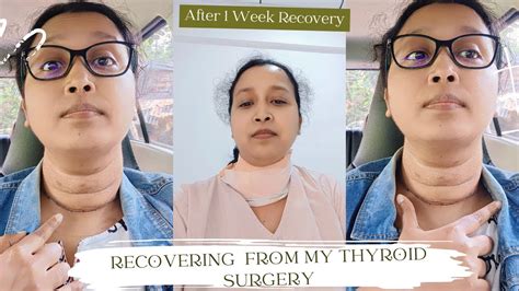thyroid removal surgery story  recovering  thyroid surgery