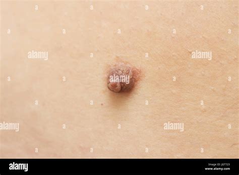 mole on a skin Stock Photo - Alamy