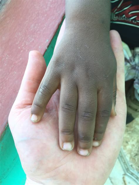 Eye Clinic at CLM - Sheridan Lutheran Church