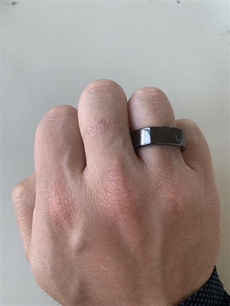 Wearing Oura Ring On Ring Finger at Guadalupe Wolf blog