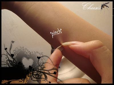 What do you do to a mozzie bite? | Cheeserland