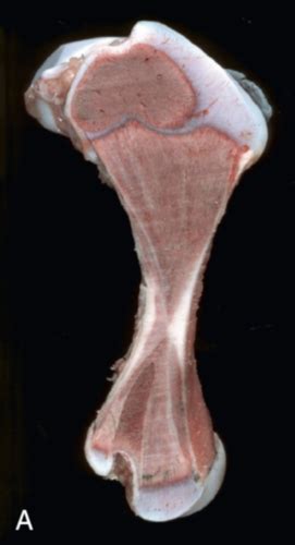 pathology bone  flashcards quizlet