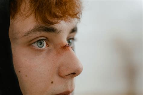 Wound Photos, Download The BEST Free Wound Stock Photos & HD Images