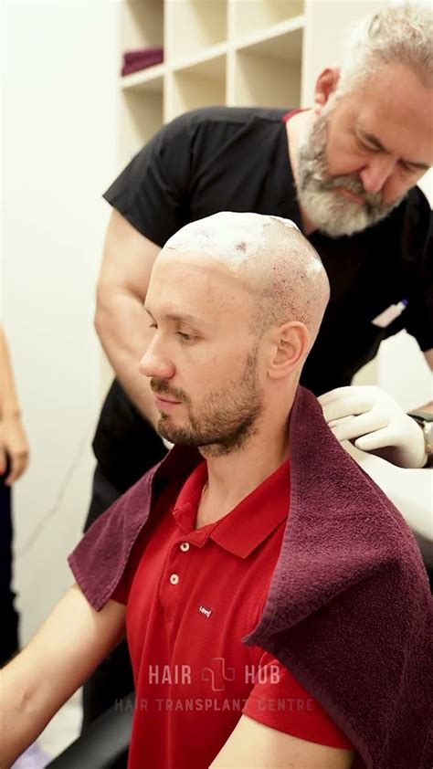 Мойка головы после пересадки волос в Hairhub clinic #shorts # ...